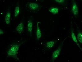 FGF21 Antibody - Immunofluorescent staining of HeLa cells using anti-FGF21 mouse monoclonal antibody.