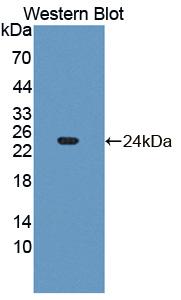 FGF21 Antibody - Western blot of FGF21 antibody.