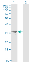 FGF21 Antibody - Western blot of FGF21 expression in transfected 293T cell line by FGF21 monoclonal antibody (M01), clone 2F11.