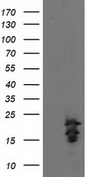 FGF21 Antibody - HEK293T cells were transfected with the pCMV6-ENTRY control (Left lane) or pCMV6-ENTRY FGF21 (Right lane) cDNA for 48 hrs and lysed. Equivalent amounts of cell lysates (5 ug per lane) were separated by SDS-PAGE and immunoblotted with anti-FGF21.