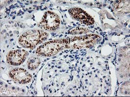 FGF21 Antibody - IHC of paraffin-embedded Human Kidney tissue using anti-FGF21 mouse monoclonal antibody.
