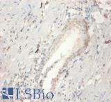 FGF21 Antibody - Immunohistochemistry of paraffin-embedded human prostate using FGF21 antibody at dilution of 1:100.  This image was taken for the unconjugated form of this product. Other forms have not been tested.