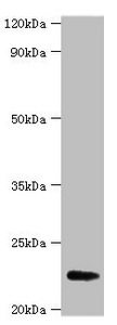 FGF21 Antibody - Western blot All lanes: Fibroblast growth factor 21 antibody at 2µg/ml + A549 whole cell lysate Secondary Goat polyclonal to rabbit IgG at 1/15000 dilution Predicted band size: 23 kDa Observed band size: 23 kDa