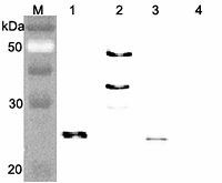 FGF21 Antibody - Western blot analysis of human FGF21 using anti-FGF-21 (human), pAb at 1:4,000 dilution. 1. Recombinant human FGF21 (FLAG-tagged). 2. Recombinant human FGF21 (Fc protein). 3. Recombinant human FGF21 (His-tagged). 4. Recombinant mouse Visfatin (FLAG-tagged) (negative control).