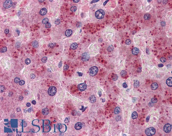 FGF21 Antibody - Anti-FGF21 antibody IHC of human liver. Immunohistochemistry of formalin-fixed, paraffin-embedded tissue after heat-induced antigen retrieval. Antibody concentration 5 ug/ml.  This image was taken for the unconjugated form of this product. Other forms have not been tested.