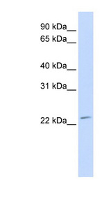 FGF21 Antibody - FGF21 antibody Western blot of 293T cell lysate. This image was taken for the unconjugated form of this product. Other forms have not been tested.