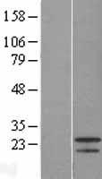 FGF21 Protein - Western validation with an anti-DDK antibody * L: Control HEK293 lysate R: Over-expression lysate