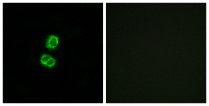 FGF22 Antibody - Immunofluorescence analysis of MCF7 cells, using FGF22 Antibody. The picture on the right is blocked with the synthesized peptide.