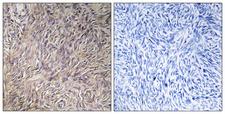 FGF22 Antibody - Immunohistochemistry analysis of paraffin-embedded human ovary tissue, using FGF22 Antibody. The picture on the right is blocked with the synthesized peptide.