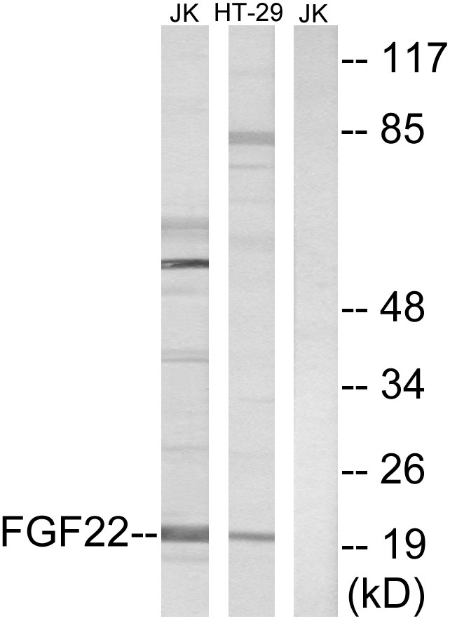 FGF22 Antibody - Western blot analysis of lysates from Jurkat and HT-29 cells, using FGF22 Antibody. The lane on the right is blocked with the synthesized peptide.