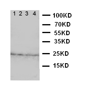 FGF22 Antibody - WB of FGF22 antibody. Lane 1: Rat Ovary Tissue Lysate. Lane 2: Rat Ovary Tissue Lysate. Lane 3: Rat Testis Tissue Lysate. Lane 4: Rat Testis Tissue Lysate.