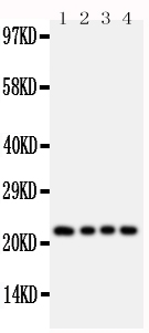 FGF22 Antibody - Anti-FGF22 antibody, Western blotting Lane 1: Rat Ovary Tissue LysateLane 2: Rat Ovary Tissue LysateLane 3: Rat Testis Tissue LysateLane 4: Rat Testis Tissue Lysate