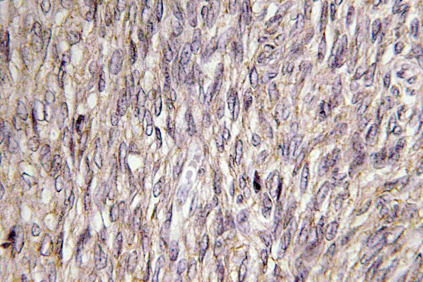 FGF22 Antibody - IHC of FGF-22 (A96) pAb in paraffin-embedded human ovary tissue.