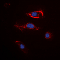 FGF22 Antibody - Immunofluorescent analysis of FGF22 staining in K562 cells. Formalin-fixed cells were permeabilized with 0.1% Triton X-100 in TBS for 5-10 minutes and blocked with 3% BSA-PBS for 30 minutes at room temperature. Cells were probed with the primary antibody in 3% BSA-PBS and incubated overnight at 4 ??C in a humidified chamber. Cells were washed with PBST and incubated with a DyLight 594-conjugated secondary antibody (red) in PBS at room temperature in the dark. DAPI was used to stain the cell nuclei (blue).