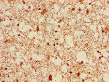 FGF22 Antibody - Immunohistochemistry image of paraffin-embedded human brain tissue at a dilution of 1:100
