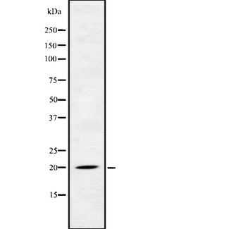 FGF22 Antibody - Western blot analysis FGF-22 using Jurkat whole cells lysates
