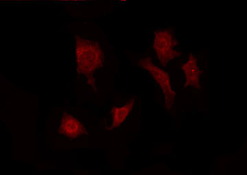 FGF22 Antibody - Staining HeLa cells by IF/ICC. The samples were fixed with PFA and permeabilized in 0.1% Triton X-100, then blocked in 10% serum for 45 min at 25°C. The primary antibody was diluted at 1:200 and incubated with the sample for 1 hour at 37°C. An Alexa Fluor 594 conjugated goat anti-rabbit IgG (H+L) Ab, diluted at 1/600, was used as the secondary antibody.
