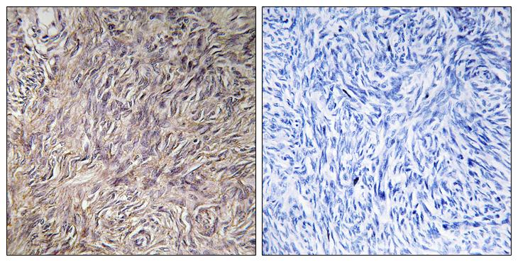 FGF22 Antibody - Peptide - + Immunohistochemistry analysis of paraffin-embedded human ovary tissue using FGF22 antibody.