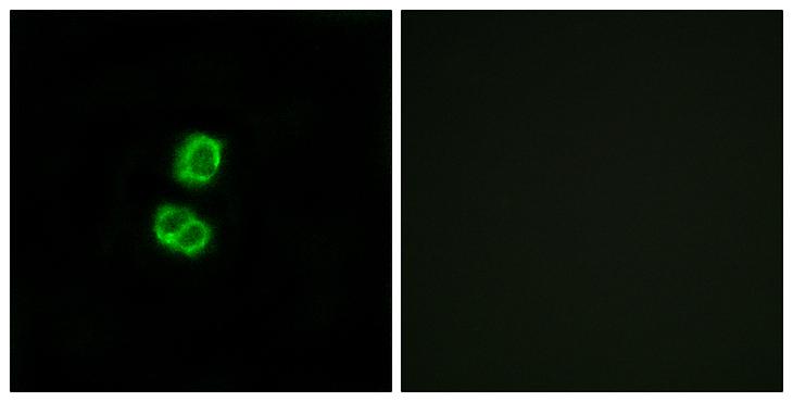 FGF22 Antibody - Peptide - + Immunofluorescence analysis of MCF-7 cells, using FGF22 antibody.