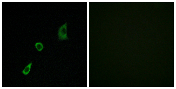 FGF23 Antibody - Immunofluorescence analysis of HUVEC cells, using FGF23 Antibody. The picture on the right is blocked with the synthesized peptide.