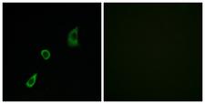FGF23 Antibody - Immunofluorescence analysis of HUVEC cells, using FGF23 Antibody. The picture on the right is blocked with the synthesized peptide.