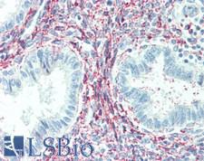 FGF23 Antibody - Human Uterus: Formalin-Fixed, Paraffin-Embedded (FFPE)