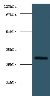 FGF23 Antibody - western blot All lanes: Fibroblast growth factor 23 antibody at 2 ug/ml+rat heart tissue. Secondary antibody: goat polyclonal to rabbit at 1:10000 dilution. Predicted band size: 28 kDa. Observed band size: 28 kDa.  This image was taken for the unconjugated form of this product. Other forms have not been tested.