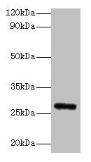 FGF23 Antibody - Western blot All lanes: Fibroblast growth factor 23 antibody at 2µg/ml + Rat heart tissue Secondary Goat polyclonal to rabbit IgG at 1/10000 dilution Predicted band size: 28 kDa Observed band size: 28 kDa