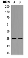 FGF23 Antibody - Western blot analysis of FGF23 expression in A549 (A); H9C2 (B) whole cell lysates.