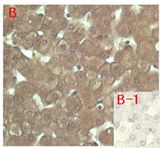 FGF23 Antibody - Immunohistochemical staining of human tissue using anti-FGF-23 (human), mAb (FG322-3) at 1:200 dilution. A. Immunoperoxidase staining (cytoplasmic) of formalin-fixed, paraffin-embedded human liver (200x, brown color). B. Isotype control with IgG1 (negative control).