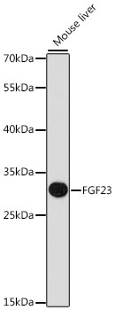 FGF23 Antibody - Western blot analysis of extracts of mouse liver, using FGF23 antibody at 1:1000 dilution. The secondary antibody used was an HRP Goat Anti-Rabbit IgG (H+L) at 1:10000 dilution. Lysates were loaded 25ug per lane and 3% nonfat dry milk in TBST was used for blocking. An ECL Kit was used for detection and the exposure time was 90s.