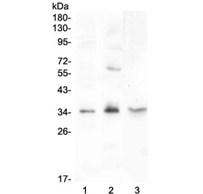 FGF23 Antibody - Western blot testing of 1) rat testis, 2) rat PC-12 and 3) mouse testis lysate with FGF23 antibody at 0.5ug/ml. Predicted molecular weight: 28-32 kDa.