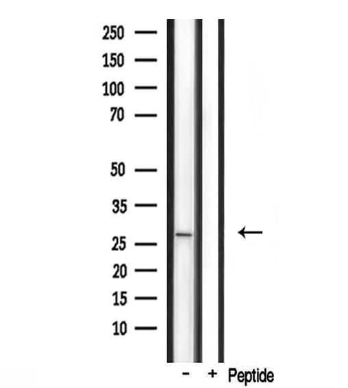FGF23 Antibody - Western blot analysis of FGF23 antibody expression in mouse lung tissue lysates. The lane on the right is treated with the antigen-specific peptide.