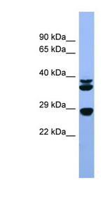 FGF3 Antibody - FGF3 antibody western blot of Rat Liver lysate.  This image was taken for the unconjugated form of this product. Other forms have not been tested.
