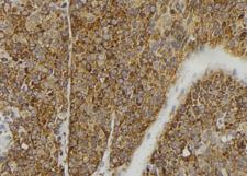 FGF3 Antibody - 1:100 staining human pancreas tissue by IHC-P. The sample was formaldehyde fixed and a heat mediated antigen retrieval step in citrate buffer was performed. The sample was then blocked and incubated with the antibody for 1.5 hours at 22°C. An HRP conjugated goat anti-rabbit antibody was used as the secondary.