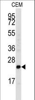FGF4 Antibody - Western blot of anti-FGF4 Antibody in CEM cell line lysates (35 ug/lane). FGF4 (arrow) was detected using the purified antibody.