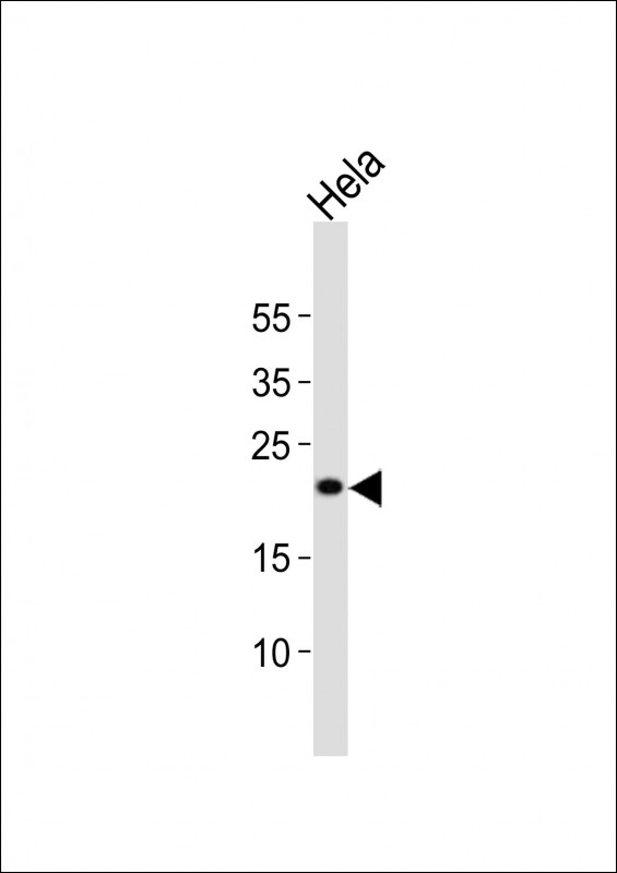 FGF4 Antibody - Western blot of lysate from HeLa cell line, using FGF4 antibody diluted at 1:4000. A goat anti-rabbit IgG H&L (HRP) at 1:10000 dilution was used as the secondary antibody. Lysate at 20 ug.