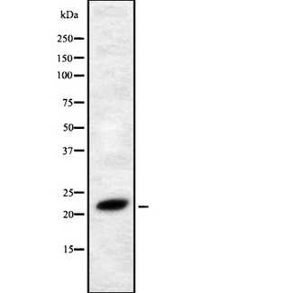 FGF4 Antibody - Western blot analysis FGF4 using RAW264.7 whole cells lysates
