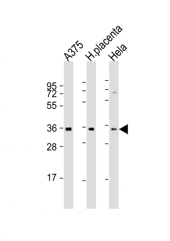 FGF5 Antibody - All lanes: Anti-FGF5 Antibody (N-Term) at 1:2000 dilution. Lane 1: A375 whole cell lysate. Lane 2: human placenta lysate. Lane 3: HeLa whole cell lysate Lysates/proteins at 20 ug per lane. Secondary Goat Anti-Rabbit IgG, (H+L), Peroxidase conjugated at 1:10000 dilution. Predicted band size: 30 kDa. Blocking/Dilution buffer: 5% NFDM/TBST.