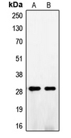 FGF5 Antibody - Western blot analysis of FGF5 expression in A375 (A); NIH3T3 (B) whole cell lysates.