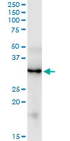 FGF5 Antibody - FGF5 monoclonal antibody (M01), clone 1B4. Western Blot analysis of FGF5 expression in human colon.