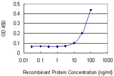 FGF5 Antibody - Detection limit for recombinant GST tagged FGF5 is 3 ng/ml as a capture antibody.