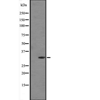 FGF5 Antibody - Western blot analysis of FGF5 expression in human placenta tissue lysate (in RIPA buffer). The lane on the left is treated with the antigen-specific peptide.