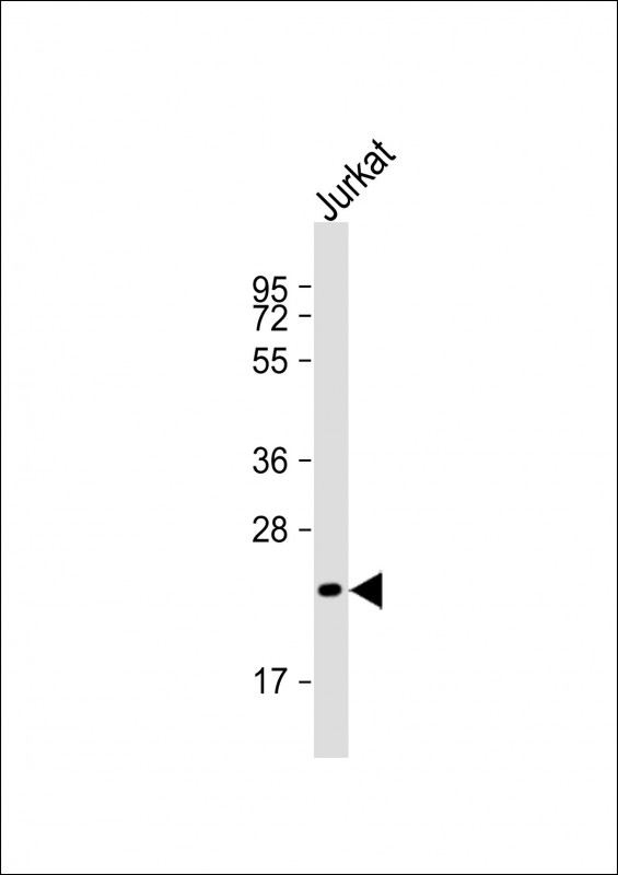 FGF6 Antibody - Anti-FGF6 Antibody (Center)at 1:2000 dilution + Jurkat whole cell lysates Lysates/proteins at 20 ug per lane. Secondary Goat Anti-Rabbit IgG, (H+L), Peroxidase conjugated at 1:10000 dilution. Predicted band size: 23 kDa. Blocking/Dilution buffer: 5% NFDM/TBST.