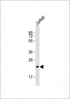 FGF6 Antibody - Anti-FGF6 Antibody (Center)at 1:2000 dilution + Jurkat whole cell lysates Lysates/proteins at 20 ug per lane. Secondary Goat Anti-Rabbit IgG, (H+L), Peroxidase conjugated at 1:10000 dilution. Predicted band size: 23 kDa. Blocking/Dilution buffer: 5% NFDM/TBST.