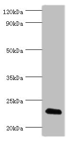 FGF6 Antibody - Western blot All lanes: FGF6 antibody at 10µg/ml + HepG2 whole cell lysate Secondary Goat polyclonal to rabbit IgG at 1/10000 dilution Predicted band size: 23 kDa Observed band size: 23 kDa