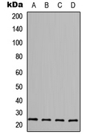 FGF6 Antibody - Western blot analysis of FGF6 expression in MCF7 (A); HepG2 (B); Raw264.7 (C); H9C2 (D) whole cell lysates.