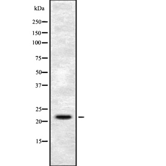 FGF6 Antibody - Western blot analysis FGF6 using HuvEc whole cells lysates