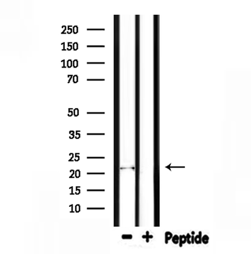 FGF6 Antibody - Western blot analysis of extracts of mouse liver tissue using FGF6 antibody.