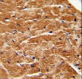 FGF7 / KGF Antibody - FGF7 antibody immunohistochemistry of formalin-fixed and paraffin-embedded human M.heart tissue followed by peroxidase-conjugated secondary antibody and DAB staining.